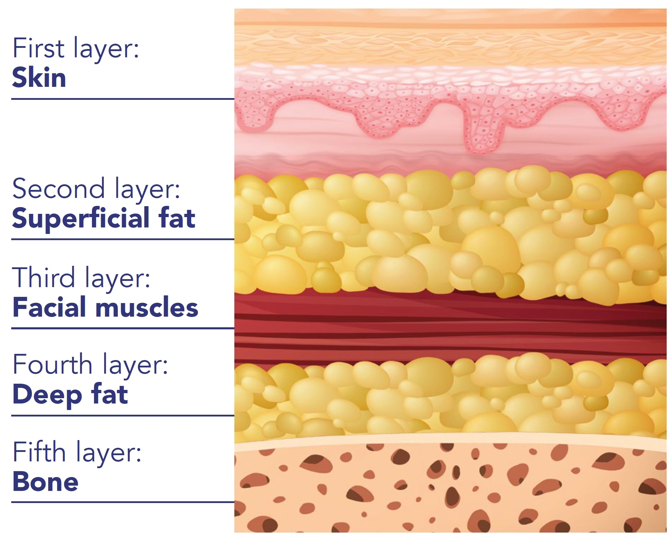 پروفایلو، پروفایلو استراکچرا، خرید پروفایلو