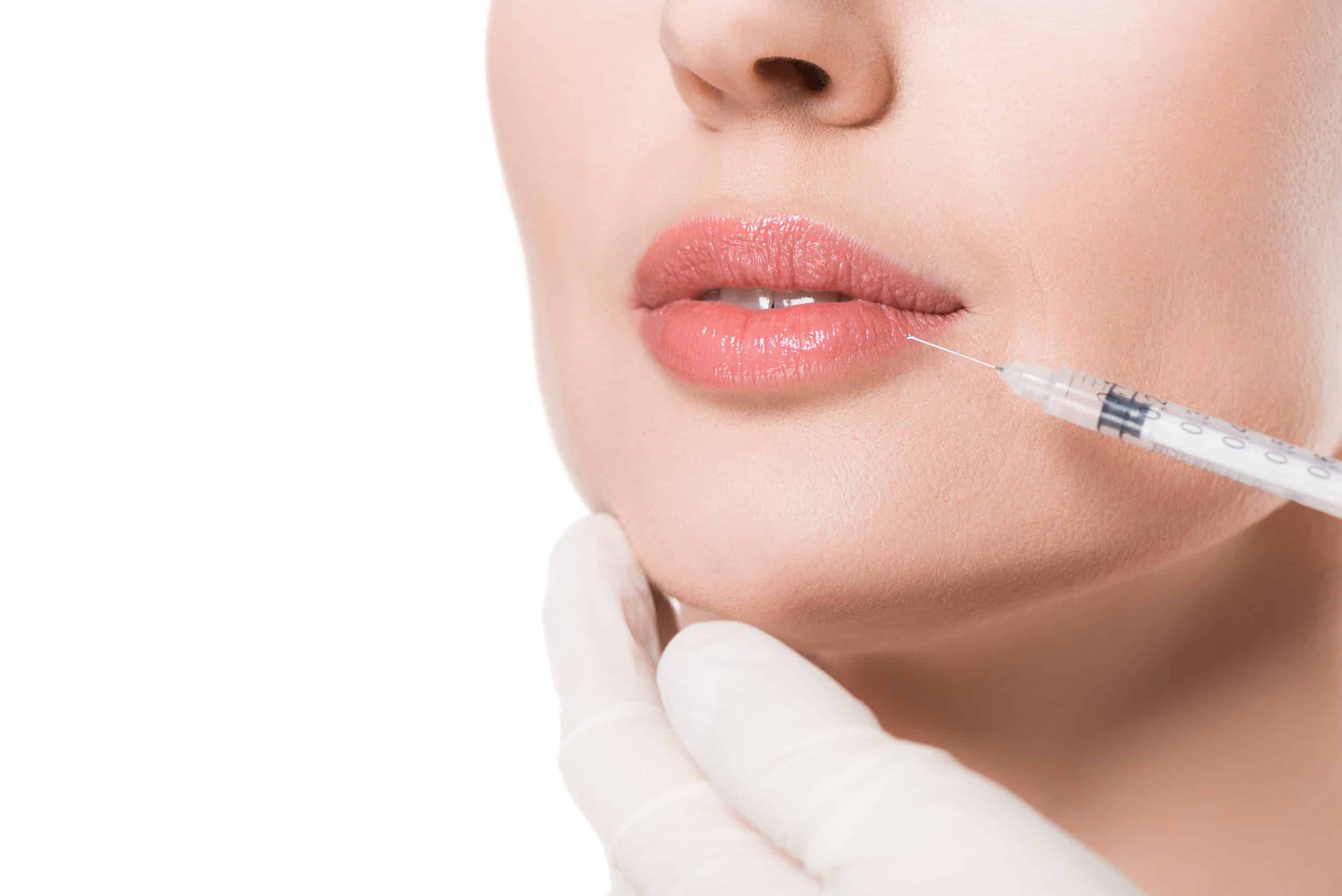 ژل استایلج، فیلر استایلج، قیمت هر سی سی ژل استایلج