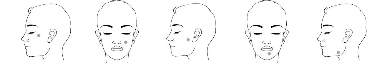 نحوه تزریق پروفایلو، آموزش تزریق پروفایلو