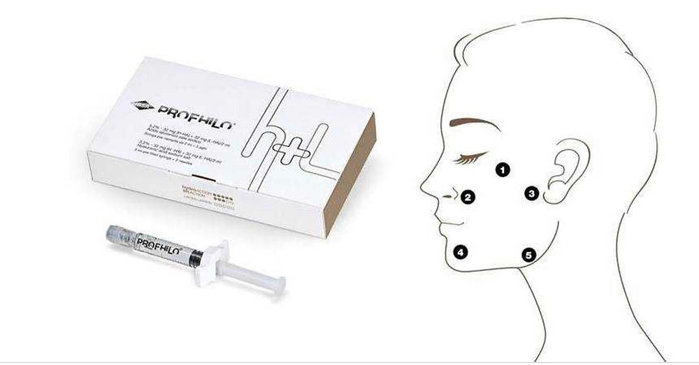 آموزش تزریق پروفایلو