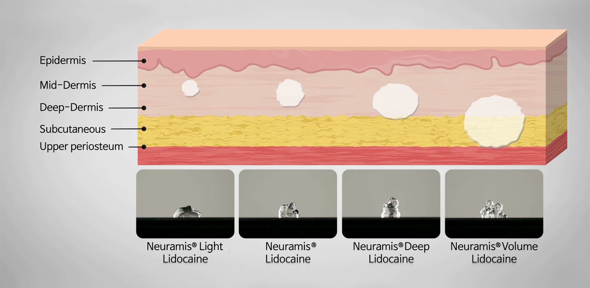 انواع نورامیس
